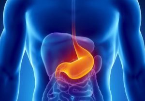 ulcer ulcer